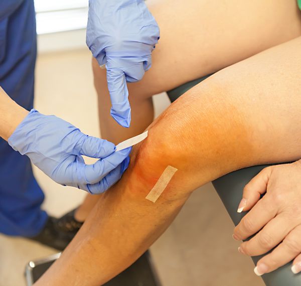 arthroscopic acl reconstruction 1