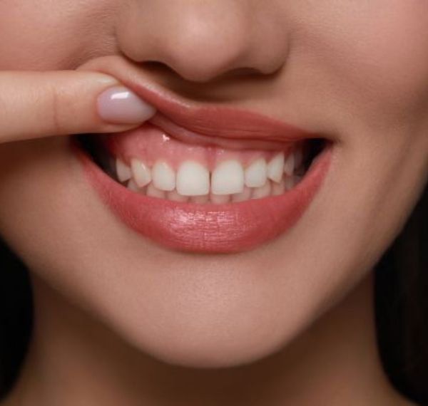 gum treatment (periodontics) (1)