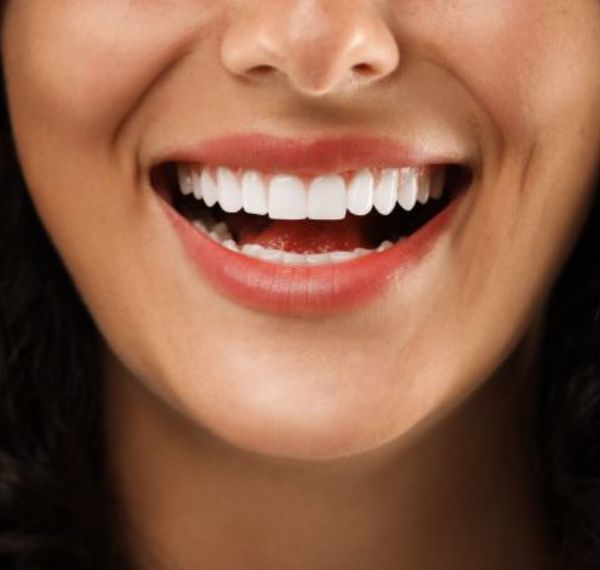 smile makeover