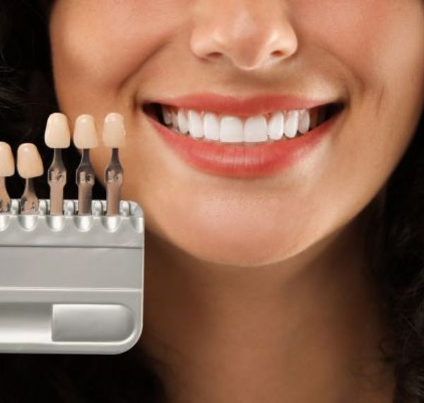 teeth whitening